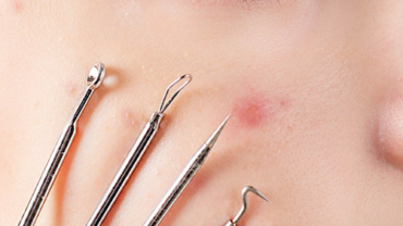 SKIN AESTHETIC TREATMENTS