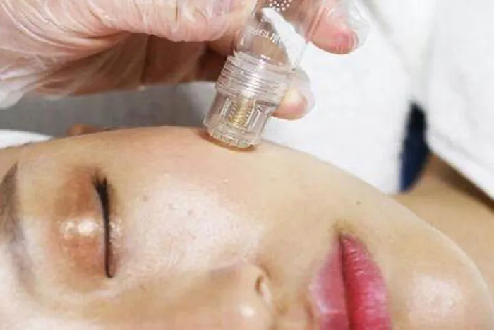 Micro-Infusion System